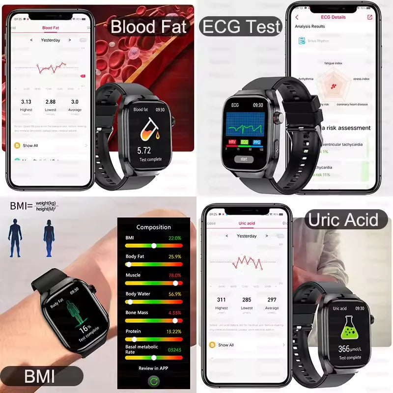Xiaomi 2025 New Three highs Blood Pressure Smartwatch ECG Uric Acid Heart Rate Clock Body Analysis Health Monitoring Watches