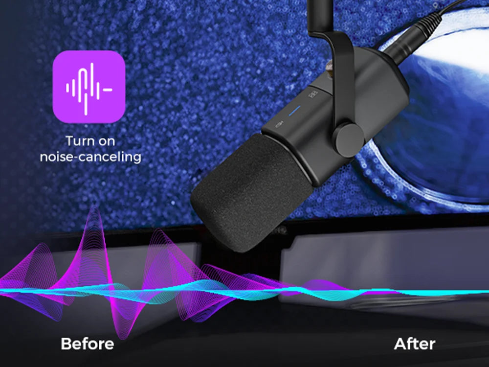 NearStream Dynamic XLR USB Mic Desktop Professional Microphone Plug-and-Play for Gaming Studio Streaming Podcast Recording pc