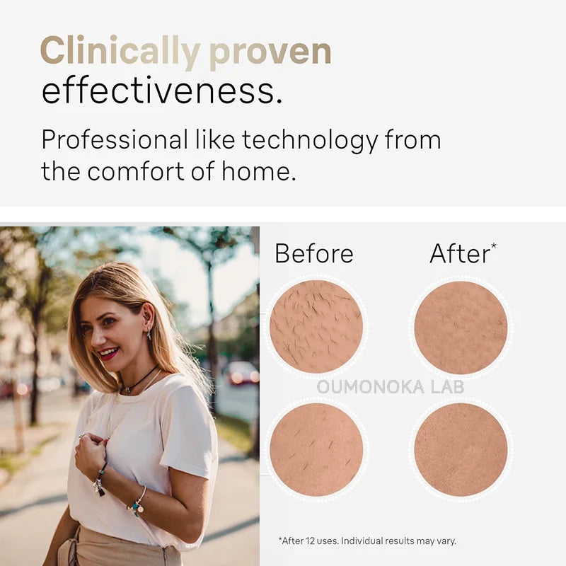 999999 Flashes 3-in-1 IPL Laser Epilator for Women Home Use Devices Electric Hair Removal Painless Machine Bikini Dropshipping