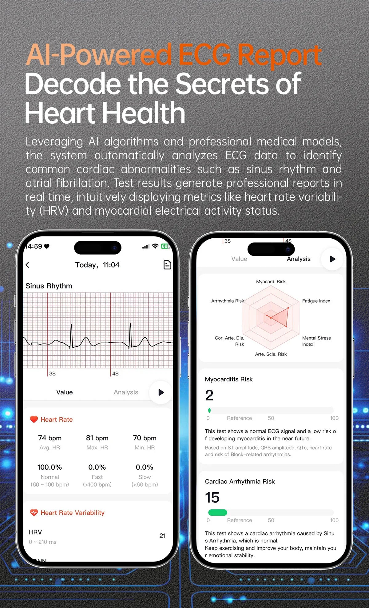 2025 New NFC  Health MonitorUric Acid Blood Pressure Blood oxygen Body Analysis Smart Watch ECG+PPG Clock Smartwatch Men lady