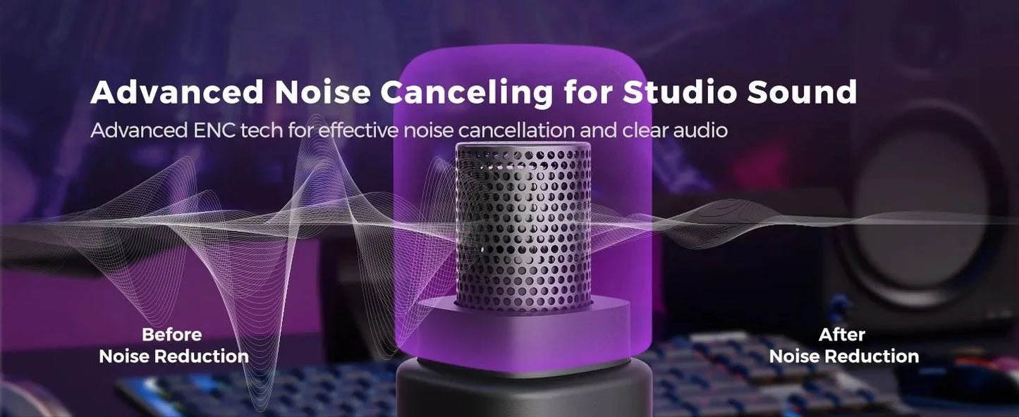 NearStream Condenser USB XLR Microphone Desktop Plug-and-Play Professional Mic pc for Gaming Streaming podcast studio Recording