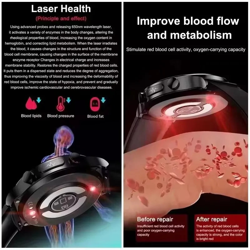 For Xiaomi Precise Laser Therapy Bracelet Uric Acid Blood Lipid ECG+PPG Health  Smart Watch Bluetooth Call Smartwatches 2025 New